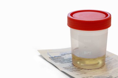 Container with urine and direction, disposable container for taking and transporting biomaterial samples