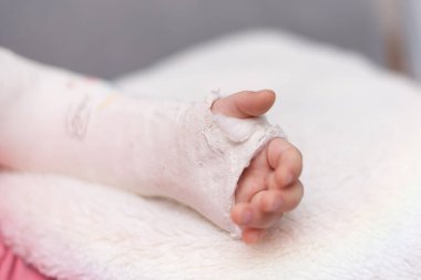 Kızın sol kolu kırık, koluna güzel bir resim çizmiş.