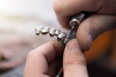 Diş protezleri, protezler, protezler. Bir çalışma masası ve diş aletleri