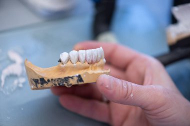 Diş protezleri, protezler, protezler. Bir çalışma masası ve diş aletleri