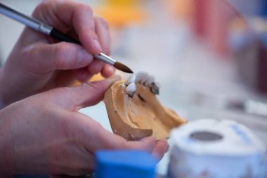 Diş protezleri, protezler, protezler. Bir çalışma masası ve diş aletleri