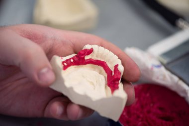 Diş protezleri, protezler, protezler. Bir çalışma masası ve diş aletleri