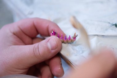 Diş protezleri, protezler, protezler. Bir çalışma masası ve diş aletleri