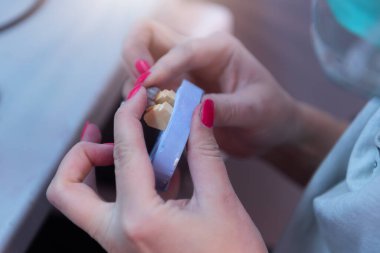 Diş protezleri, protezler, protezler. Bir çalışma masası ve diş aletleri