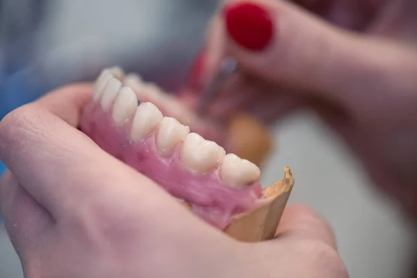 Tandprotes Proteser Proteser Studie Och Ett Bord Med Dentala Verktyg — Stockfoto