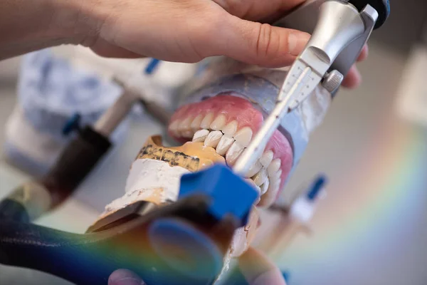 Diş Protezleri Protezler Protezler Bir Çalışma Masası Diş Aletleri — Stok fotoğraf