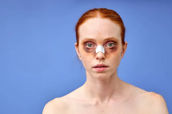 Indoor shot di pallida giovane donna avvolto in bende, ha lividi post-operatorio — Foto Stock