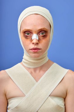 Burnu alçılı ve başı bandajlı mutsuz bir kadının portresi.
