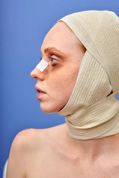 Sidovy på blek ung kvinna insvept i bandage, har postopererade blåmärken — Stockfoto