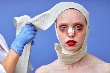 Kesilmiş doktor ameliyattan sonra kadın başındaki bandajı çıkarıyor.