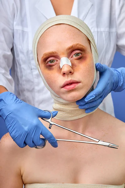 Fêmea doente com hematomas faz injeção para dobra nasolabial, close-up retrato — Fotografia de Stock