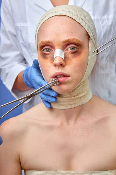 Ung hona med blåmärken injicerar näsblod veck, närbild porträtt — Stockfoto