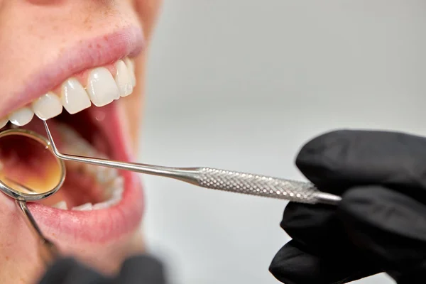 Οδοντίατρος που εξετάζει τα δόντια των ασθενών, κοντινό πλάνο φωτογραφία, corpped πρόσωπο. — Φωτογραφία Αρχείου