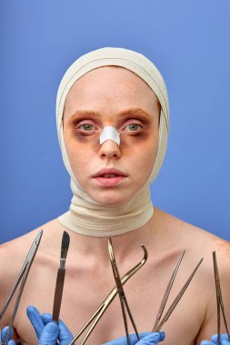 Kadın, zorlu bir ameliyattan sonra sargıya sarıldı. Burnu kırıldı.