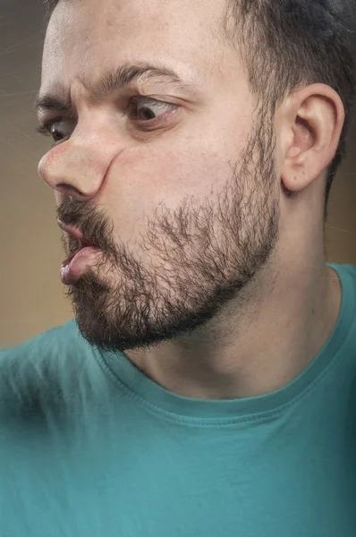 Young man smashing his face against the scratched glass — Stock Photo, Image