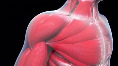 Bu 3D animasyon omuz yaralanmasını gösteriyor. Rotatör manşetinde küçük bir hilal yırtığı var.