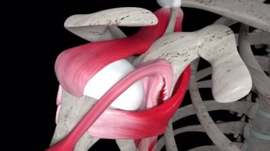 Bu 3 boyutlu tıbbi animasyon omuz labral yırtılmasını gösteriyor.