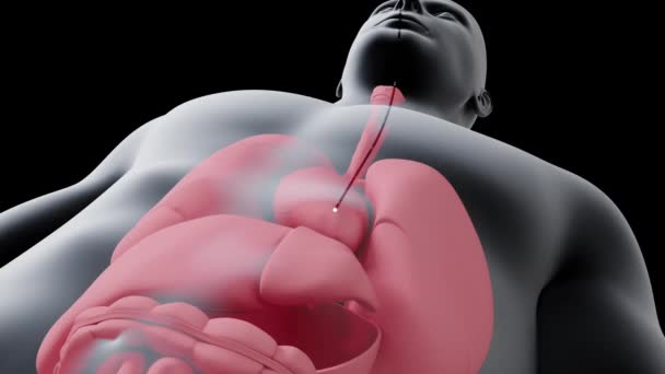 Animation Shows Gastroscopy Human Stomach — Stock Video