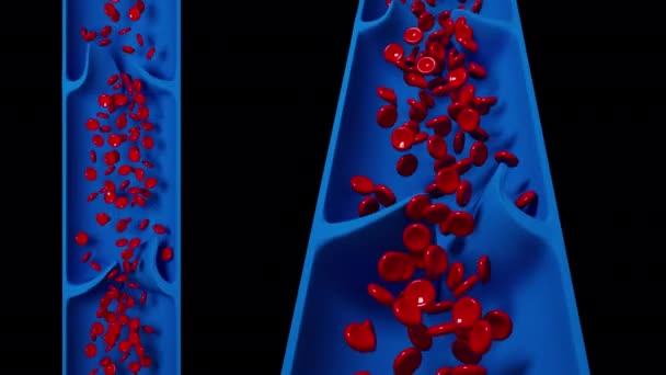 Este Vídeo Mostra Fluxo Sanguíneo Das Varizes — Vídeo de Stock