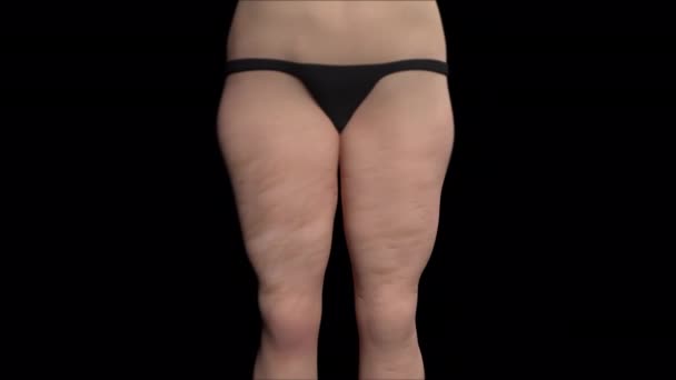 Animacja Pokazuje Niedoskonałość Cellulitu Kobiecych Udach — Wideo stockowe