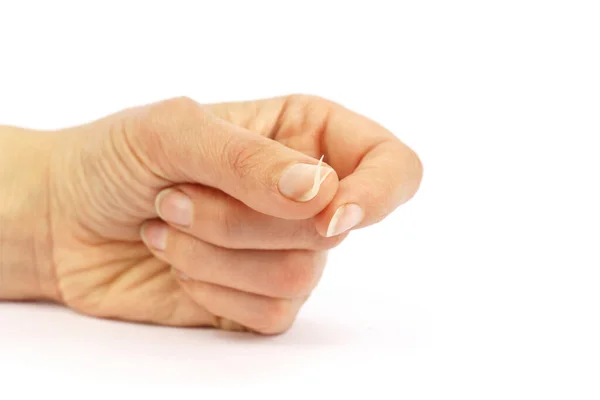 Female Hand Broken Nail Isolated White Background — Stock Photo, Image