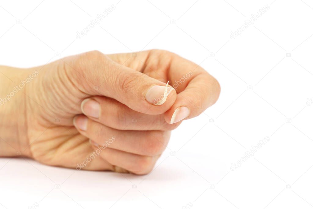 female hand with broken nail isolated on white background.