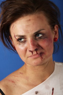 yaralanma sonra kadın