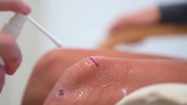 Man sprays an antiseptic agent on the wound on the childs knee. Doctor cleaning little childs leg injury in clinic, closeup. Treatment the wound. — Stock Video