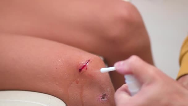 Facet spryskuje ranę środkiem antyseptycznym na kolano dziecka. Lekarz czyszczący małe dzieci w klinice, zbliżenie. Leczenie rany. — Wideo stockowe