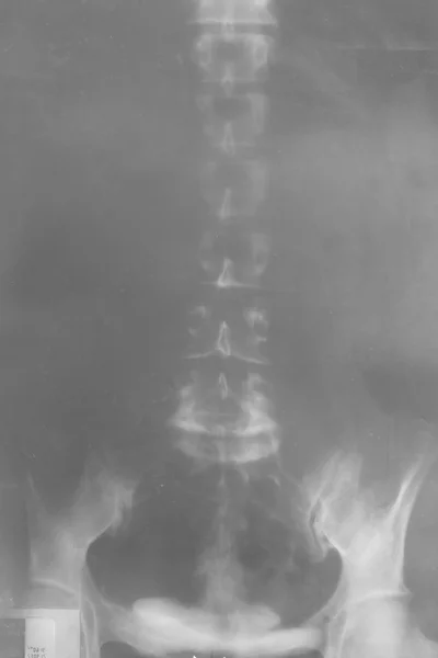 Película de rayos X — Foto de Stock