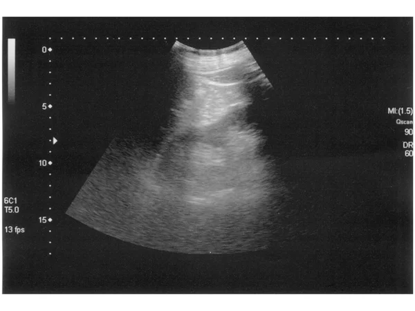 Ultrasound scan — Stock Photo, Image
