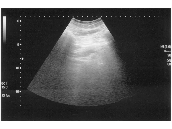 Ultrazvukové vyšetření — Stock fotografie
