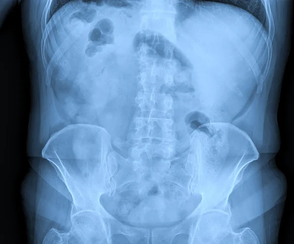 Radiografías médicas — Foto de Stock