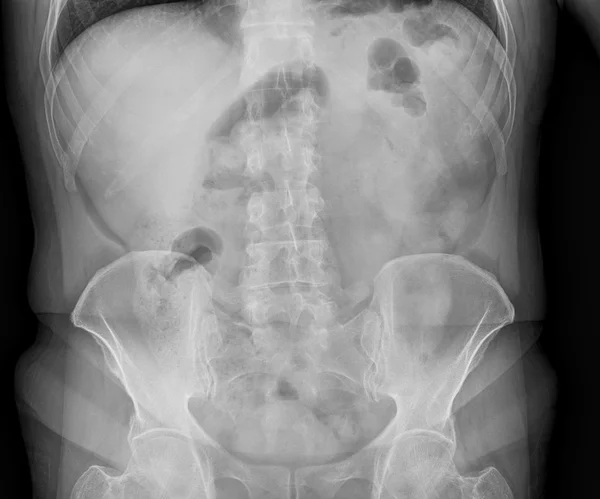 Tıbbi röntgen — Stok fotoğraf