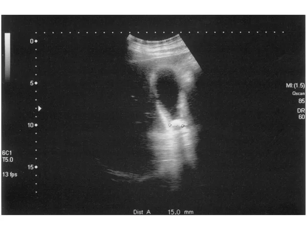 Echografie — Stockfoto