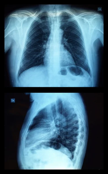 Xray — Stock Photo, Image