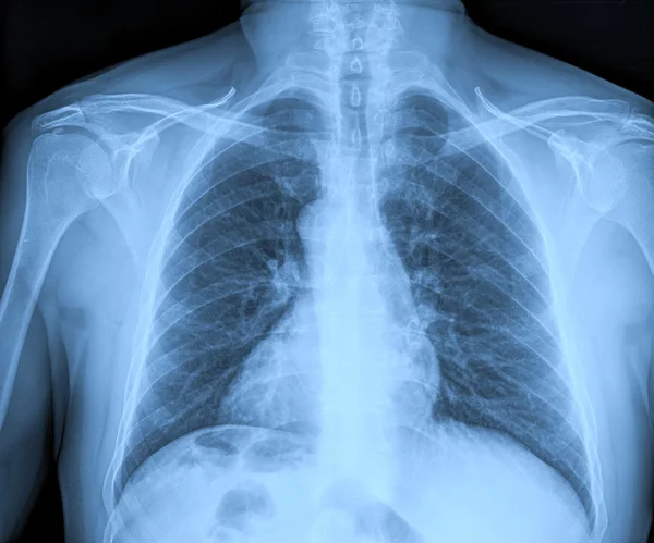 Radiografías médicas Imagen de stock