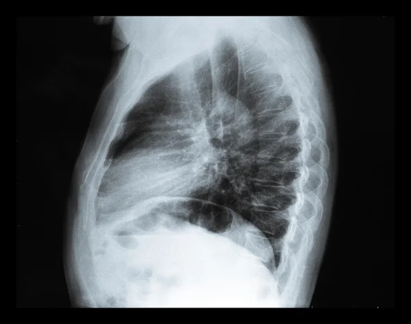 Xray — Stok fotoğraf