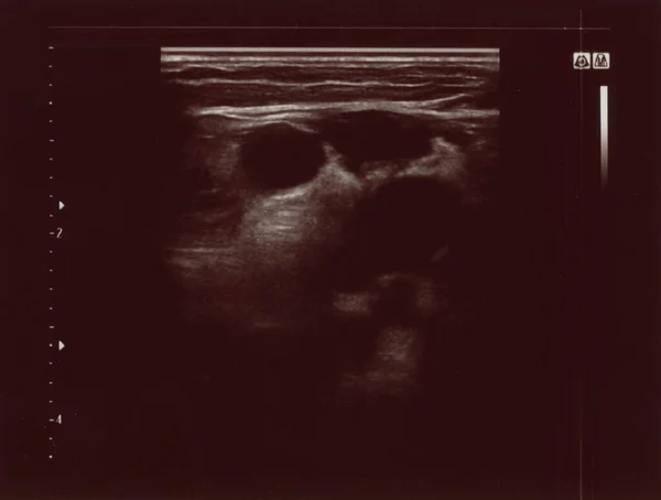 Ultrassonografia Diagnóstica Também Conhecida Como Ultrassonografia Ultrassonografia Técnica Diagnóstico Por — Fotografia de Stock