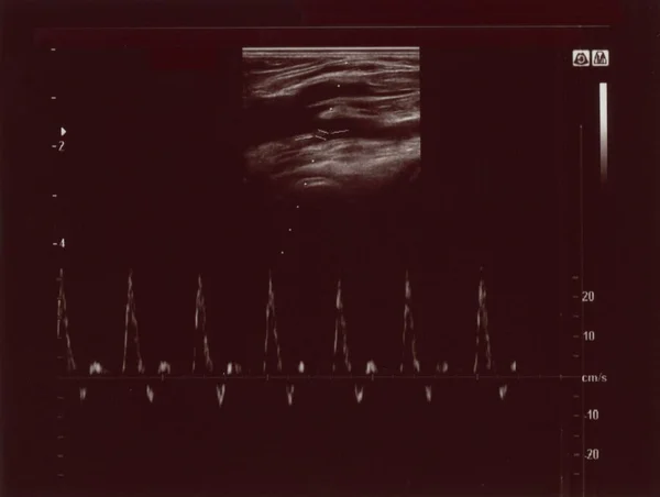 Diagnostische Sonografie Aka Ultrasonografie Echografie Echografie Gebaseerde Diagnostische Beeldvormingstechniek Gebruikt — Stockfoto