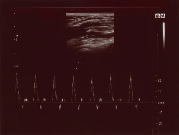 Ultrassonografia Diagnóstica Também Conhecida Como Ultrassonografia Ultrassonografia Técnica Diagnóstico Por — Fotografia de Stock