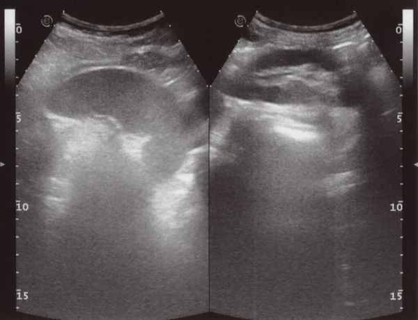 Full Abdomen Ultrasound Image Aka Diagnostic Sonogram — kuvapankkivalokuva