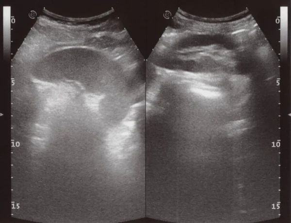 Full Abdomen Ultrasound Image Aka Diagnostic Sonogram — Zdjęcie stockowe