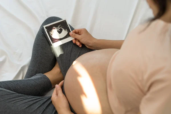 A pregnant woman is looking at an ultrasound photo of fetus. Mother gently touches the baby on stomach.Women are pregnant for 2-3 days or during the first trimester.