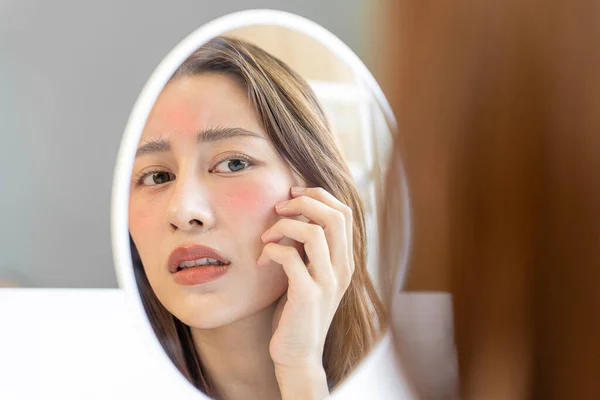 Wanita Asia Yang Cantik Khawatir Tentang Wajah Dermatologi Dan Alergi — Stok Foto