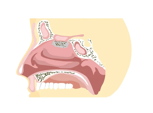 Diagrama de nariz — Archivo Imágenes Vectoriales