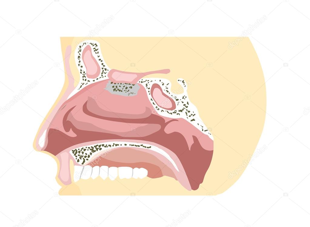 Nose Diagram