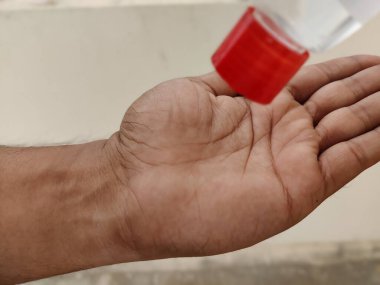 Picture of sanitizing hands with a sanitizer. It is important to maintain hand hygiene