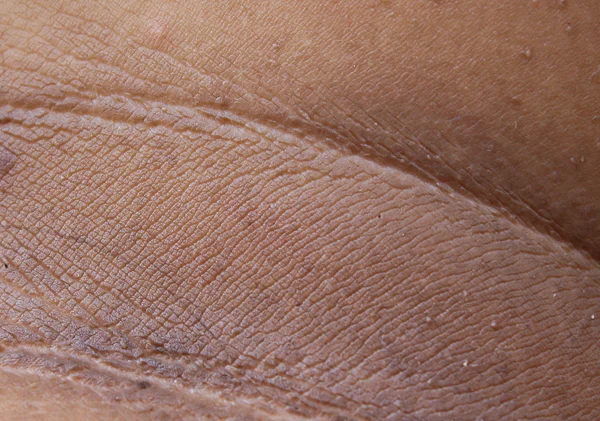 Mänsklig hud som bakgrund och halsen hud — Stockfoto