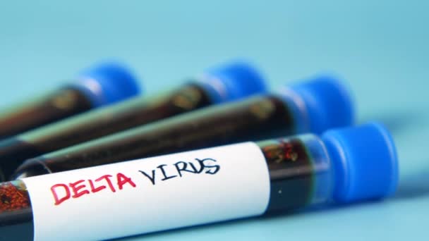 A delta corona vírus vérvizsgálati csövének közelsége kék alapon — Stock videók